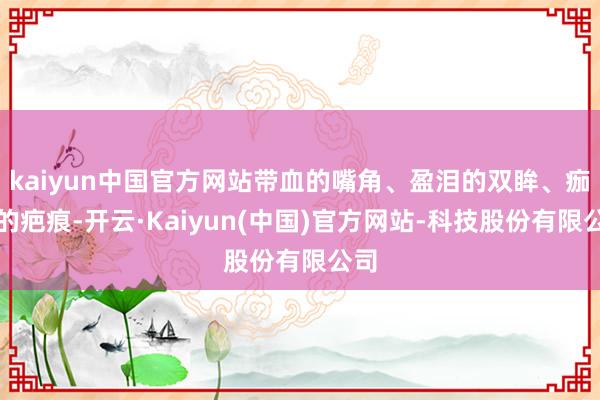 kaiyun中国官方网站带血的嘴角、盈泪的双眸、痂皮的疤痕-开云·Kaiyun(中国)官方网站-科技股份有限公司